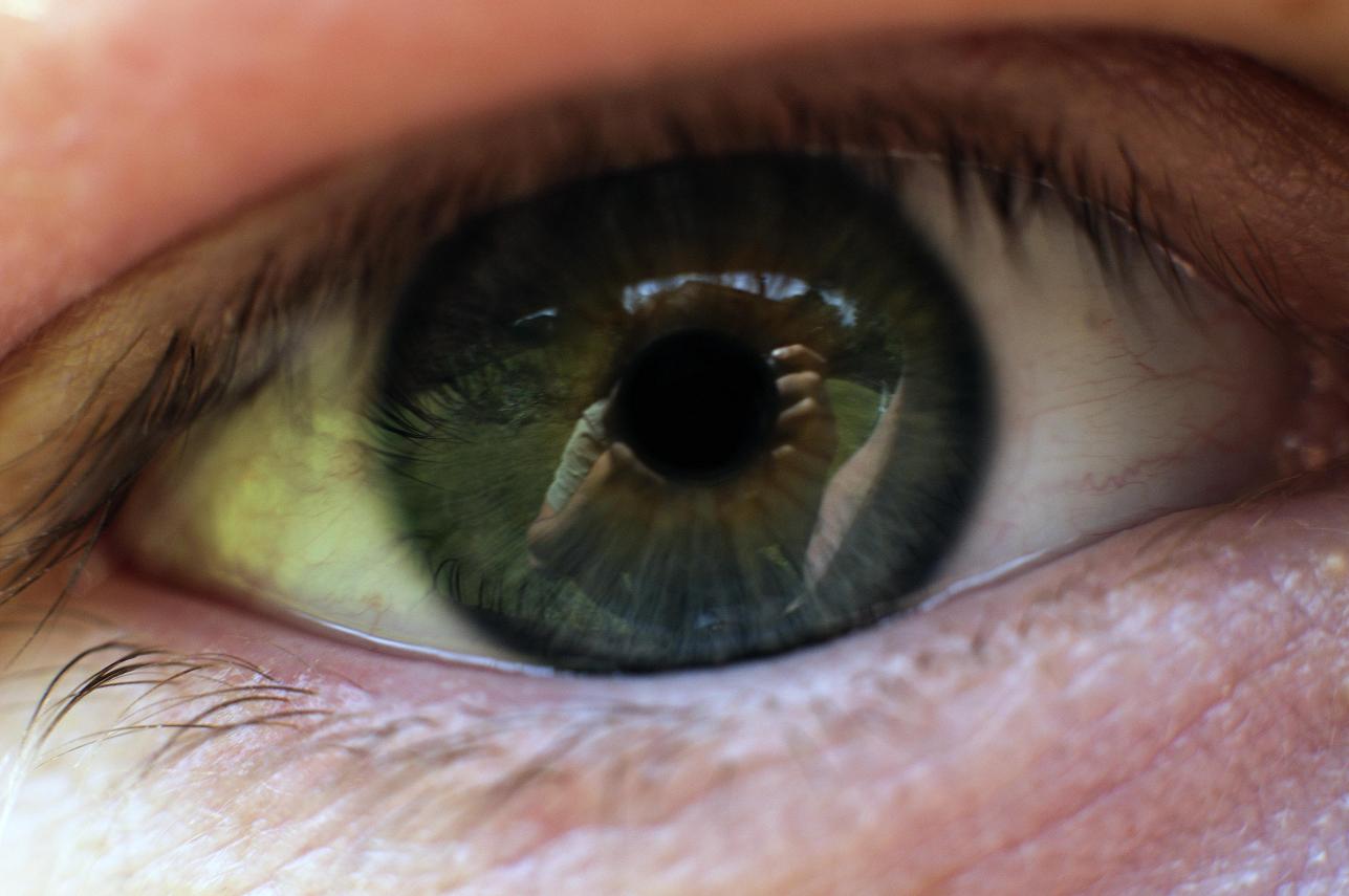 eye